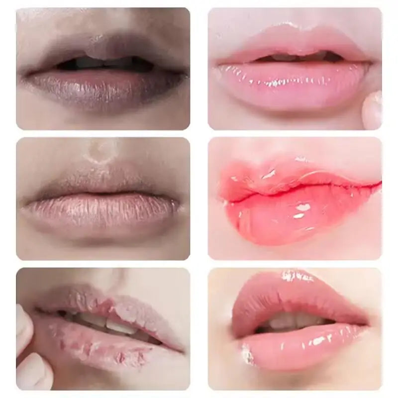 Dark Lip Lightening Balm – Pink Lip Exfoliating Moisturizer