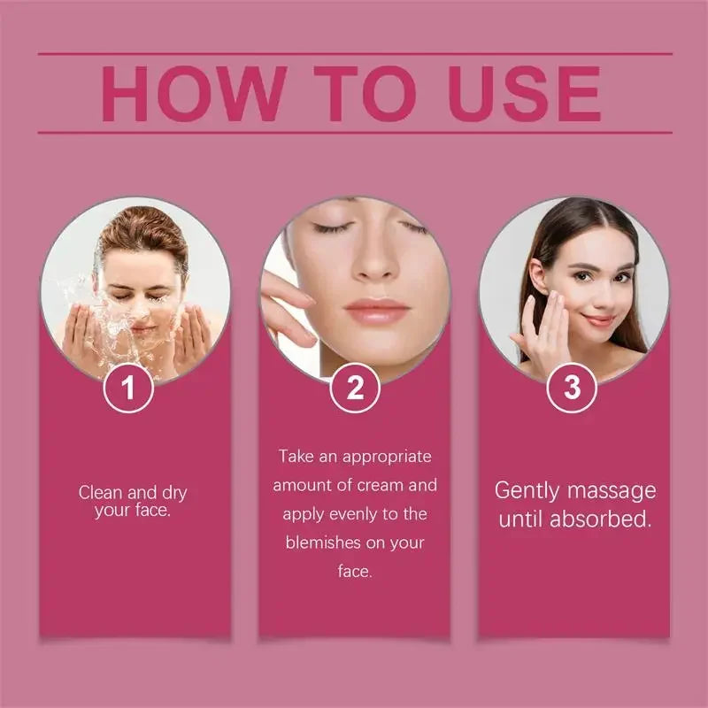 Powerful Whitening Cream – Dark Spot & Melasma Remover