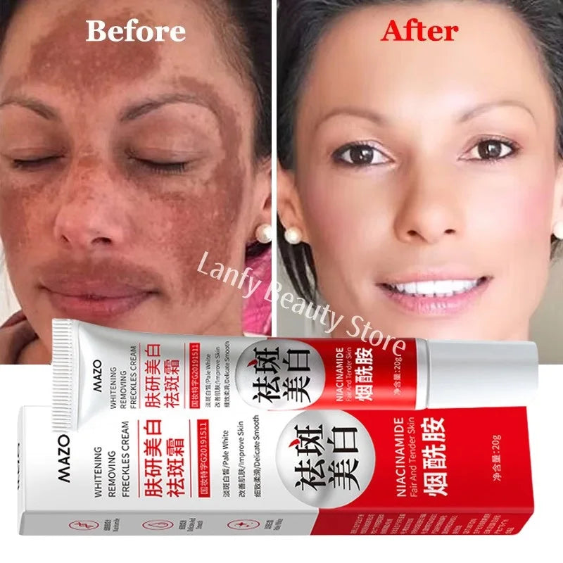 Powerful Whitening Cream – Dark Spot & Melasma Remover