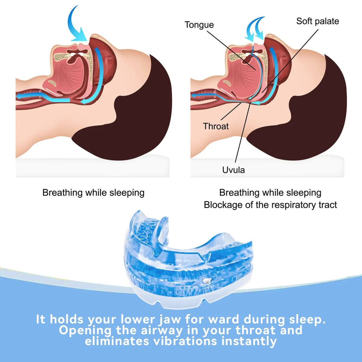 Anti-Snore Bruxism Mouth Guard – Nighttime Sleep Aid