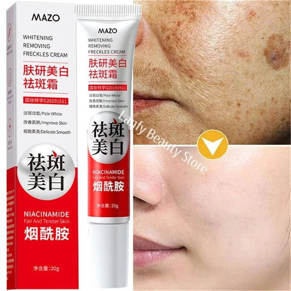 Powerful Whitening Cream – Dark Spot & Melasma Remover