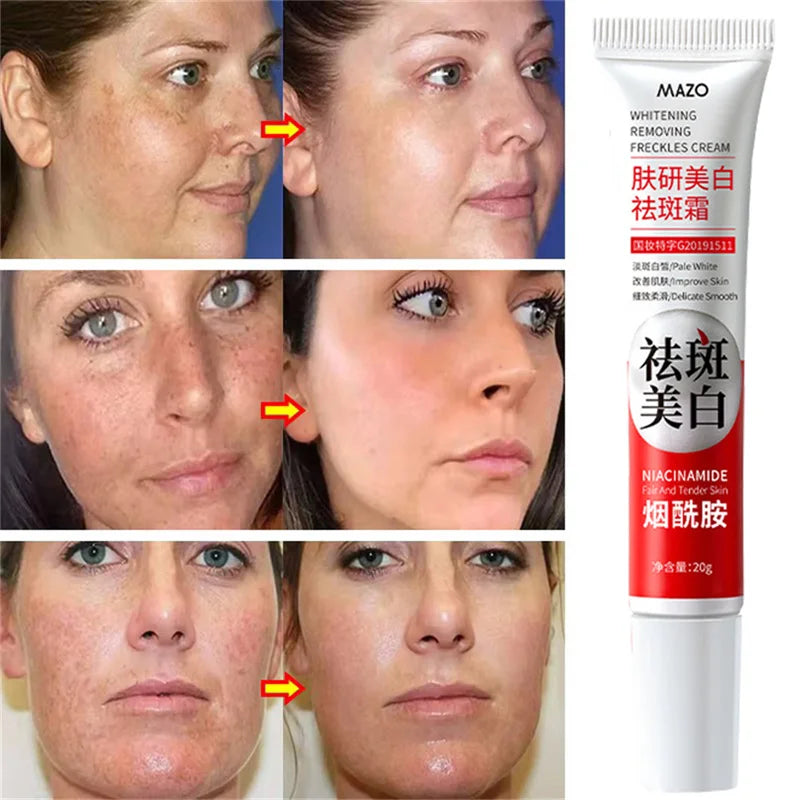 Powerful Whitening Cream – Dark Spot & Melasma Remover
