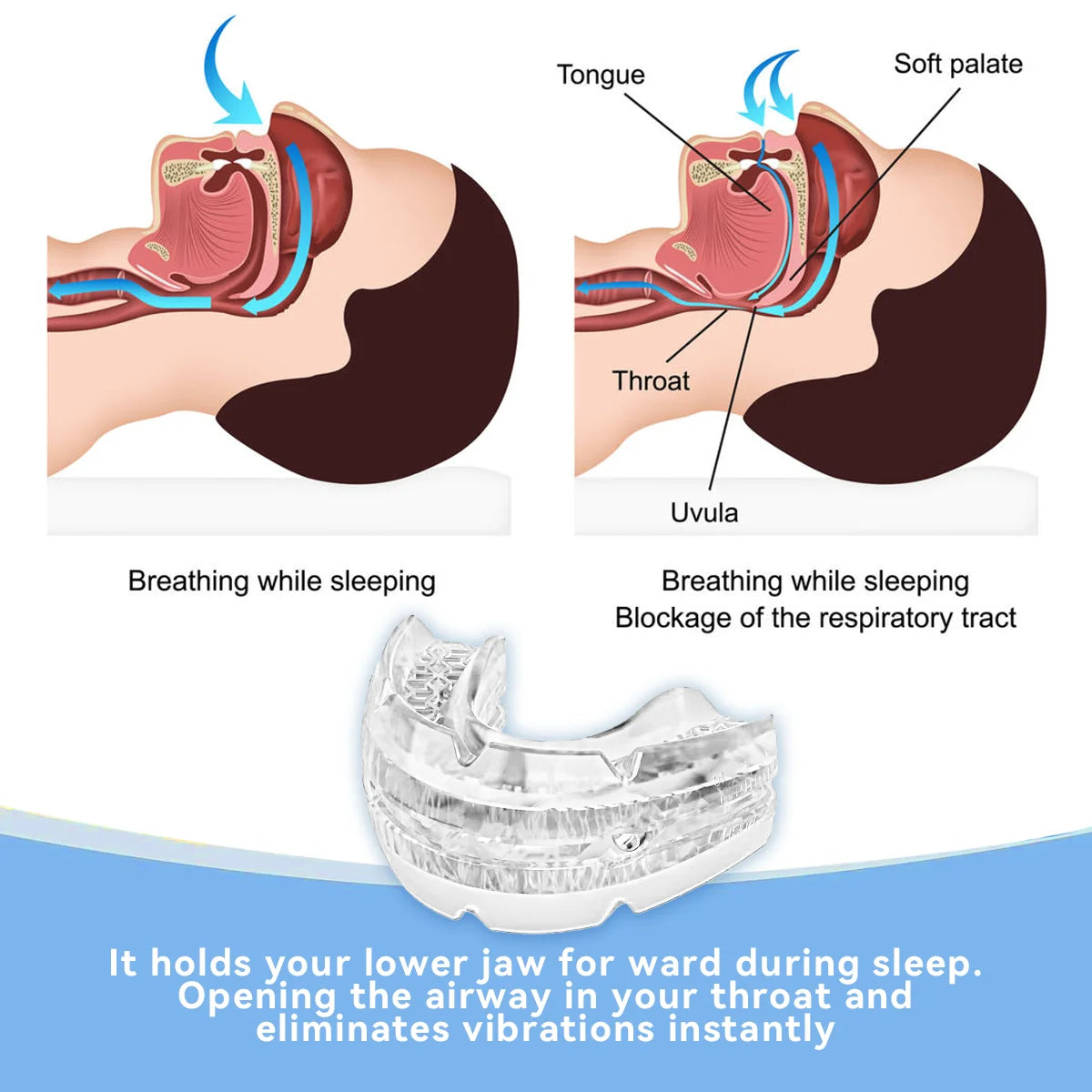 Adjustable Anti-Snoring Mouth Guard – Sleep & Bruxism Aid